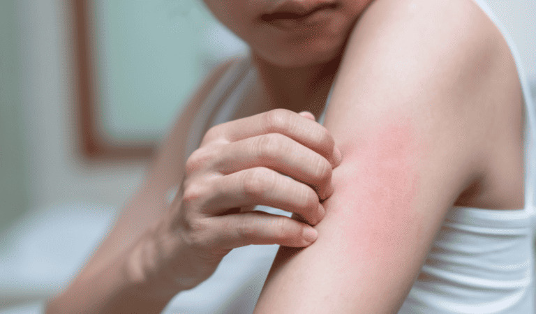 menopause itchy skin